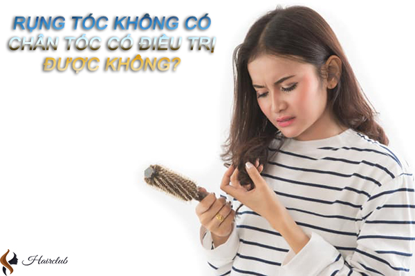 Giải đáp: Tóc rụng không có chân tóc có điều trị được không?