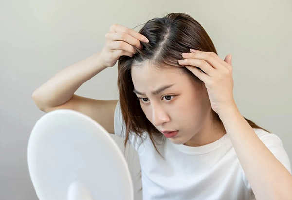 Nguyên nhân da đầu yếu gây rụng tóc