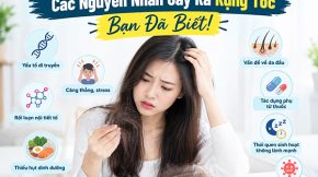 Nguyên Nhân Gây Ra Rụng Tóc_ Bạn Đã Biết_