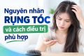 [Tìm Hiểu] : Nguyên nhân rụng tóc và cách điều trị phù hợp