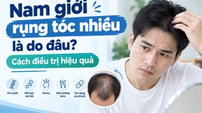 Rụng tóc nhiều ở nam giới là do đâu