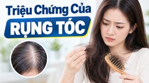 Triệu Chứng Của Rụng Tóc: Nhận Biết và Hiểu Rõ Vấn Đề
