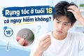 Rụng tóc tuổi 18 có nguy hiểm không?