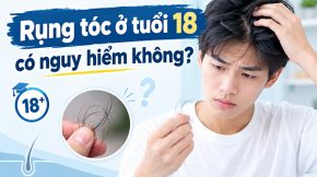 Rụng tóc tuổi 18 có nguy hiểm không?