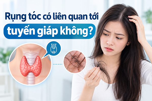 bệnh tuyến giáp có liên quan tới rụng tóc không