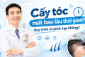 cấy tóc mất bao lâu