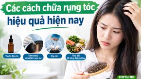 Các cách chữa rụng tóc hiệu quả hiện nay