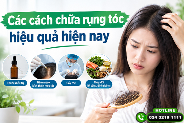 Các cách chữa rụng tóc hiệu quả hiện nay