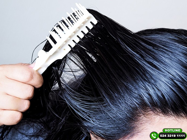 Da đầu tiết quá nhiều dầu: Nguyên nhân và cách khắc phục