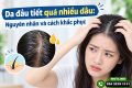 Da đầu tiết quá nhiều dầu: Nguyên nhân và cách khắc phục