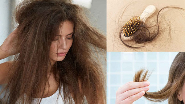 tình trạng rụng tóc hiện nay