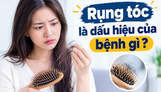 rụng tóc dấu hiệu của bệnh gi