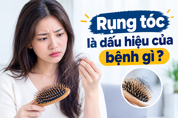 rụng tóc dấu hiệu của bệnh gi