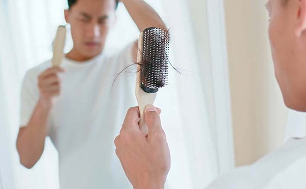 Rụng tóc ở nam tuổi 20: Nguyên nhân và giải pháp bạn cần biết