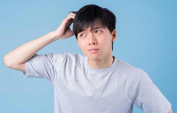 Rụng tóc ở nam giới tuổi 20: Nguyên nhân và cách khắc phục