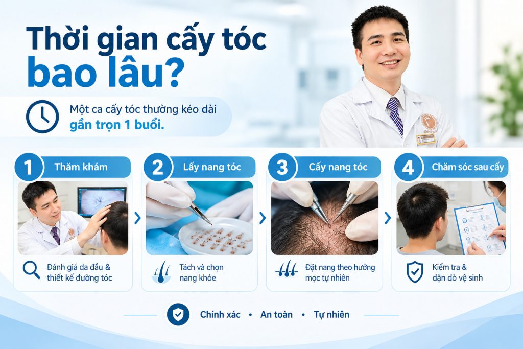 thời gian cấy tóc mất bao lâu